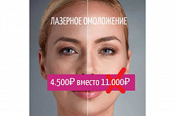 Лазерное омоложение лица — 4500 руб. вместо 11000 руб.