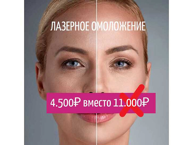 Лазерное омоложение лица — 4500 руб. вместо 11000 руб.